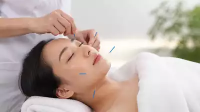 User receiving acupuncture treatment in a calm environment