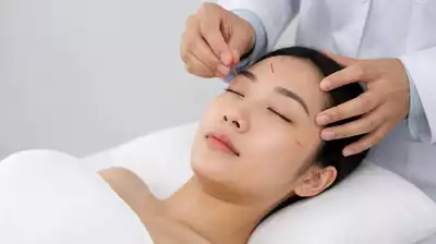 Akupunktur Therapie