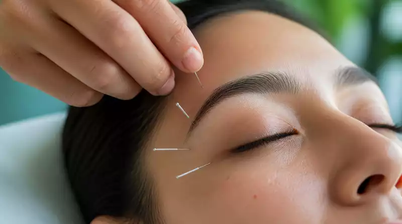 Augenakupunktur für trockene Augen