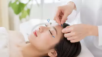 Acupuncture session focused on eye health